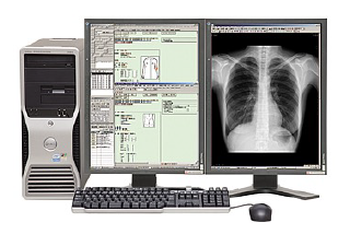 【 PACSと一体となった電子カルテシステム 】