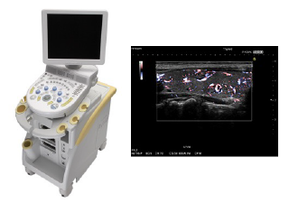 【 超音波診断装置 】